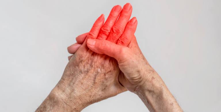 Arthritis Treatment in Ullal Main Road, Kengeri, Bangalore
