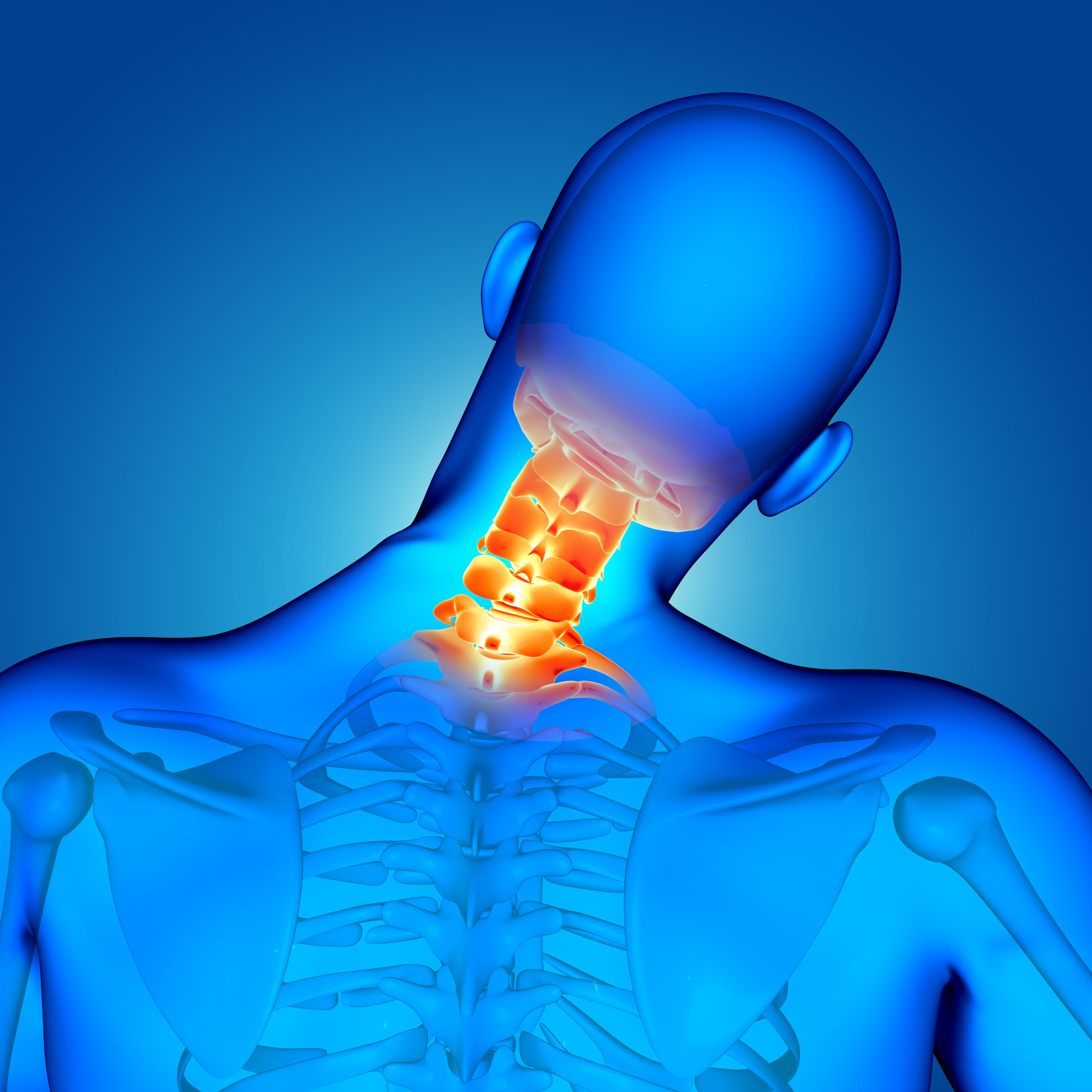 Cervical Spondylosis Treatment in Ullal Main Road, Kengeri, Bangalore